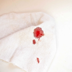 چگونگی پاک کردن لکه خون از روی لباس یا فرش دستباف
